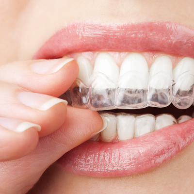 Cosmetic dentistry